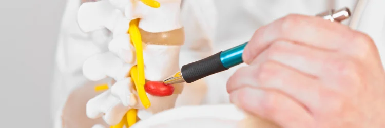 Durham NC Chiropractor Discusses Herniated Discs